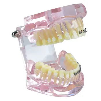 1pc Zubné Dospelých Ortodontická Model Zubné Zuby Model Zubár Pre Lekárske Vedy učiteľské Študijné Stomatológia Nástroje