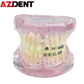 1pc Zubné Dospelých Ortodontická Model Zubné Zuby Model Zubár Pre Lekárske Vedy učiteľské Študijné Stomatológia Nástroje