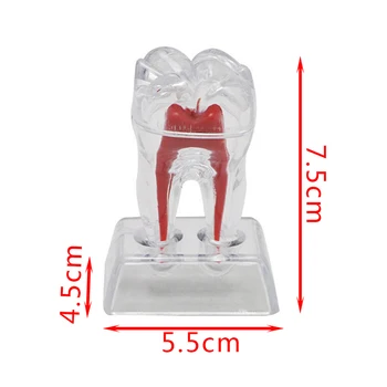 Transparentné Snímateľné Zubné Zuby Model Implantát Model Zubov Model Vyučovania Zuby Nástroj Zubné Dospelých Typodont Pre Lekárske Vedy