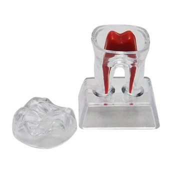 Transparentné Snímateľné Zubné Zuby Model Implantát Model Zubov Model Vyučovania Zuby Nástroj Zubné Dospelých Typodont Pre Lekárske Vedy